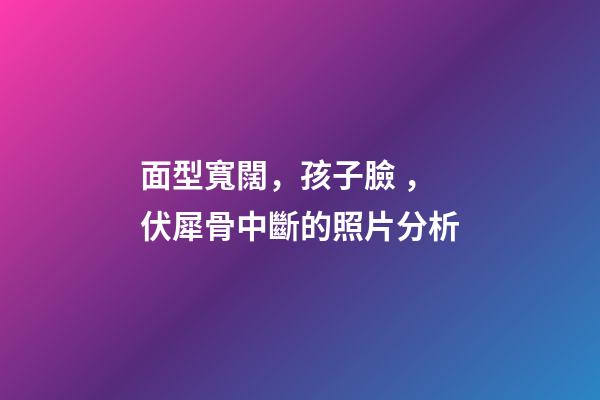 面型寬闊，孩子臉，伏犀骨中斷的照片分析